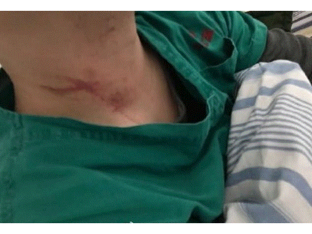 Người nhà bệnh nhân corona đánh đập bác sỹ Vũ Hán, xé rách đồ bảo hộ